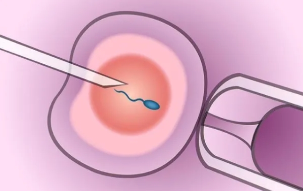卵巢功能该如何判断？卵巢储备功能减退对生育有什么影响？卵巢功能会不会影响试管婴儿成功率？