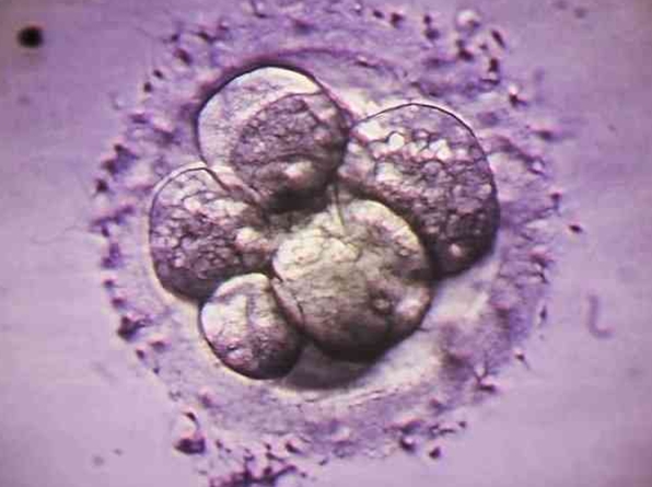 试管婴儿囊胚质量等级的具体标准是什么？试管婴儿囊胚培育时可以将囊胚分为哪几个时期？