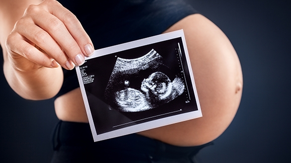 试管婴儿月经第二天直接打果纳芬是什么促排卵方案？果纳芬一般适用于试管婴儿哪些方案？