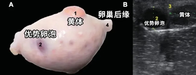 排卵障碍到底是如何发生的？试管婴儿技术如何应对排卵障碍导致的不孕？