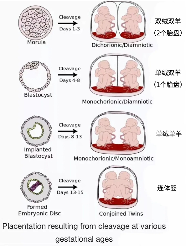 试管婴儿怀上双胞胎的概率是多少？做试管婴儿移植两个胚胎就一定能怀双胞胎？