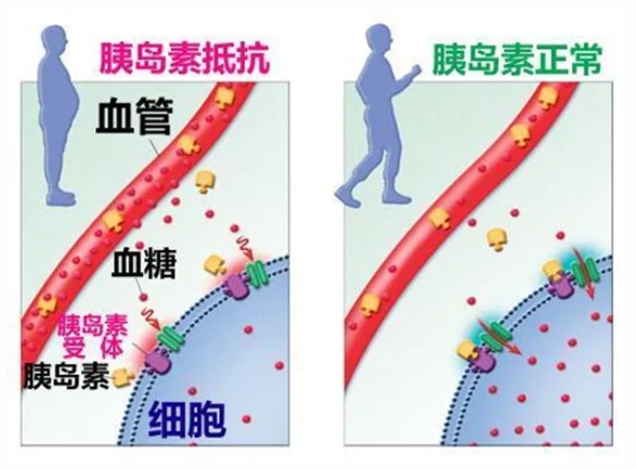 试管婴儿能帮助多囊卵巢综合征患者成功怀孕吗？多囊卵巢综合征患者怀孕后如何有效保胎？