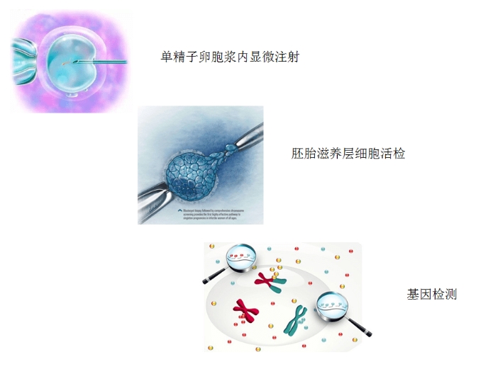 试管婴儿过程中除了金钱还需准备哪些关键因素？试管婴儿成功率与哪些心理准备和环境因素有关？