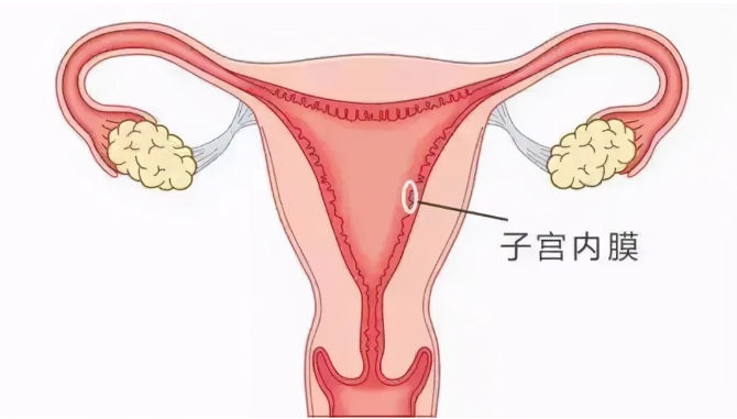 子宫内膜分ABC型是怎么回事？试管婴儿过程中子宫内膜的ABC型对胚胎着床有何影响？