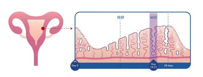 子宫内膜分ABC型是怎么回事？试管婴儿过程中子宫内膜的ABC型对胚胎着床有何影响？