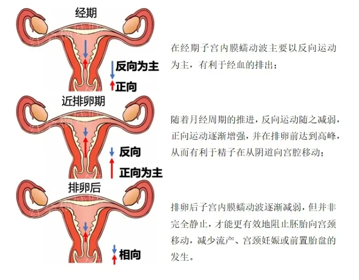 试管婴儿移植后子宫内膜蠕动波对胚胎着床有何影响？试管胚胎移植后是否着床，这个指标是关键！