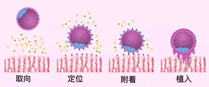 试管婴儿移植后子宫内膜蠕动波对胚胎着床有何影响？试管胚胎移植后是否着床，这个指标是关键！