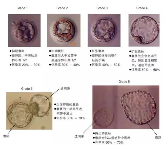 试管婴儿胚胎是如何评级的？试管婴儿胚胎评级低还有移植的必要吗？