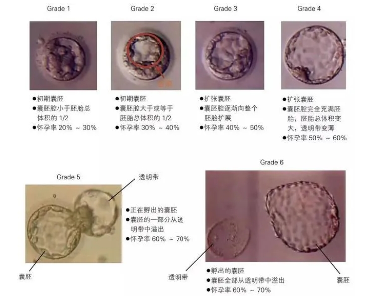 试管婴儿移植前如何科学评估囊胚质量？胚胎质量好不好，看这三个指标就知道！