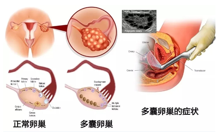 维生素D对试管婴儿过程中哪些环节产生影响？补好维生素D，试管成功率惊人提升34%！