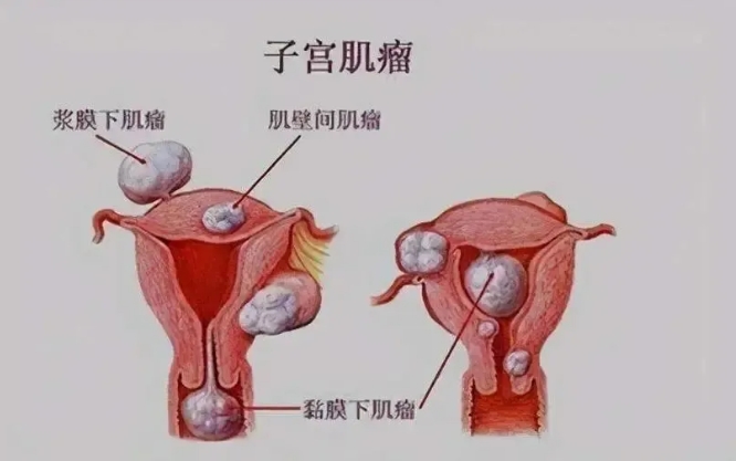 试管婴儿的过程中影响子宫内膜容受性的因素有哪些？如何提高子宫内膜容受性？