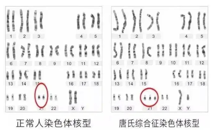 男性高龄对试管婴儿成功率有何影响？试管婴儿技术能否降低由高龄父亲引起的遗传风险？