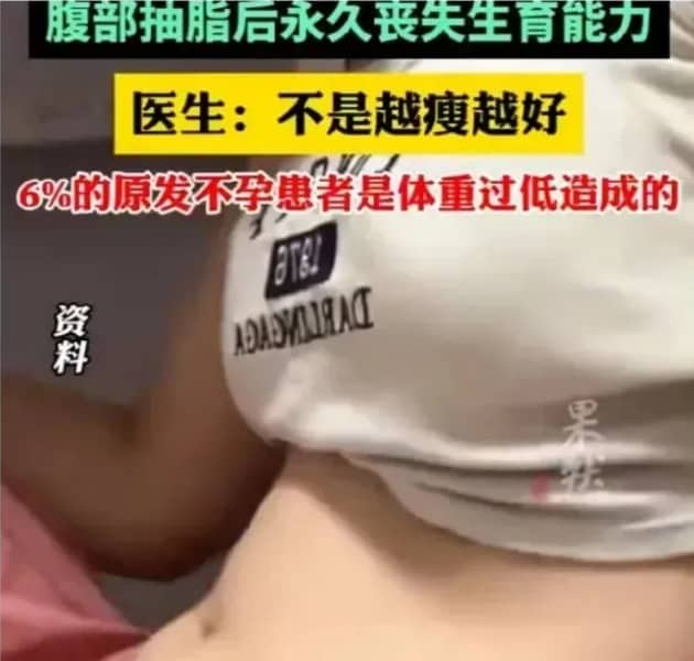 抽脂手术导致25岁女孩永久丧失生育力，过度减肥会危及生育力，减肥需谨慎！