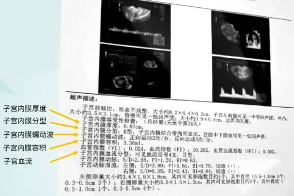 试管婴儿过程中子宫内膜容受性为何至关重要？如何通过超声检查评估试管婴儿子宫内膜容受性？