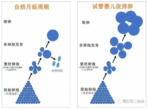 什么是试管婴儿降调？试管婴儿降调节期间可能会出现哪些情况？