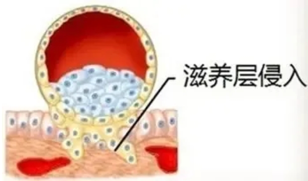 试管婴儿技术中反复移植失败的主要原因是什么？如何解决试管婴儿过程中的免疫因素导致的反复着床失败？