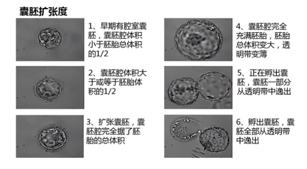 试管婴儿技术中的胚胎移植方案有哪些？如何根据身体情况选择合适的试管婴儿胚胎移植方式？