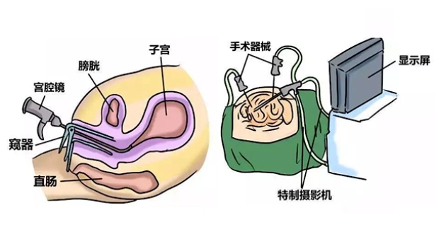 试管婴儿前女性需要做哪些医学检查？试管婴儿备孕期间应如何改善生活习惯？