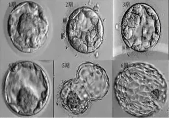 试管婴儿如何看懂胚胎报告？为什么试管婴儿解冻后的胚胎还会掉等级？