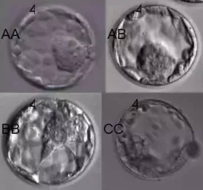 试管婴儿如何看懂胚胎报告？为什么试管婴儿解冻后的胚胎还会掉等级？