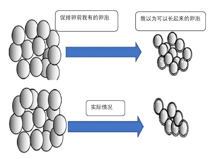 做试管婴儿为什么我的卵泡越促越少？卵泡数目越来越少的原因有哪些？如何提高促排卵后卵泡数量？