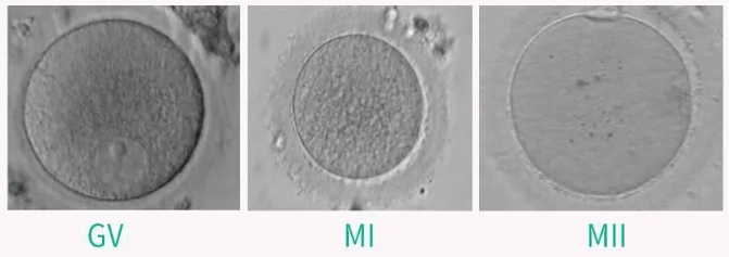 试管婴儿技术如何解决卵子成熟障碍问题？ 卵子成熟障碍对试管婴儿成功率有何影响？