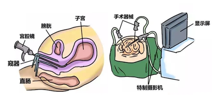 子宫内膜厚度为何对怀孕如此关键？哪些因素会影响到子宫内膜的厚度？