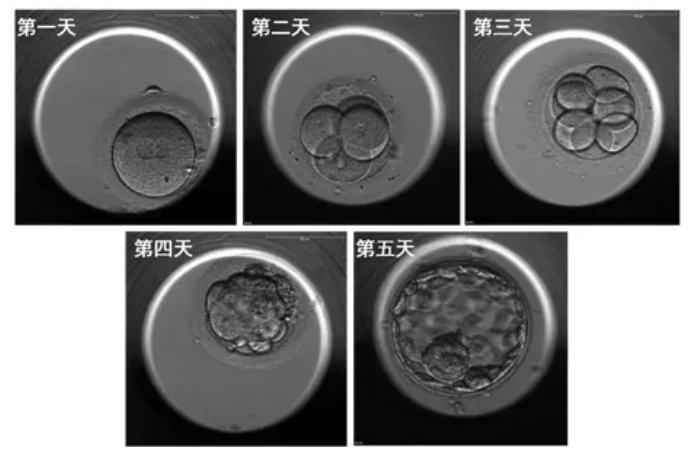 什么样的胚胎更具有好的发育潜能？