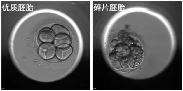 什么样的胚胎更具有好的发育潜能？