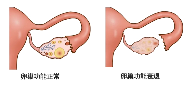 高龄女性做试管婴儿的三大难点是什么？大龄做试管婴儿该如何破局？