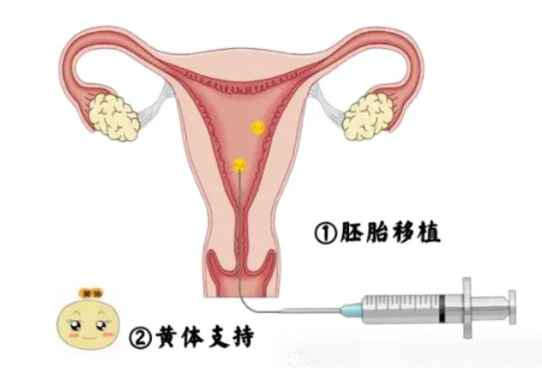 试管婴儿移植后如何正确休养以提高试管成功率？试管婴儿移植后有哪些注意事项？