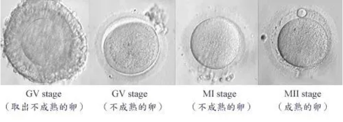 Fertilo技术是什么？Fertilo试管新技术真的能解决大龄卵少的难题？试管婴儿技术能否提高后代的生育力和健康？