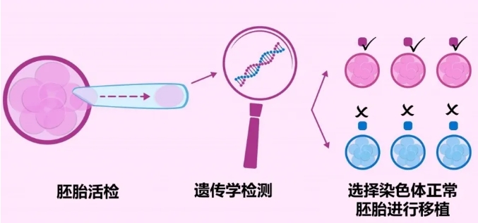 Fertilo技术是什么？Fertilo试管新技术真的能解决大龄卵少的难题？试管婴儿技术能否提高后代的生育力和健康？