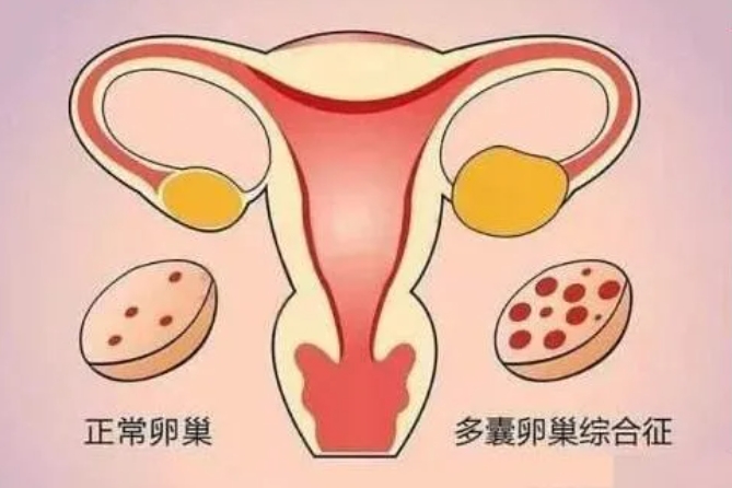 AMH的影响因素有哪些？AMH的临床作用是什么？AMH降低距离绝经还有多远？