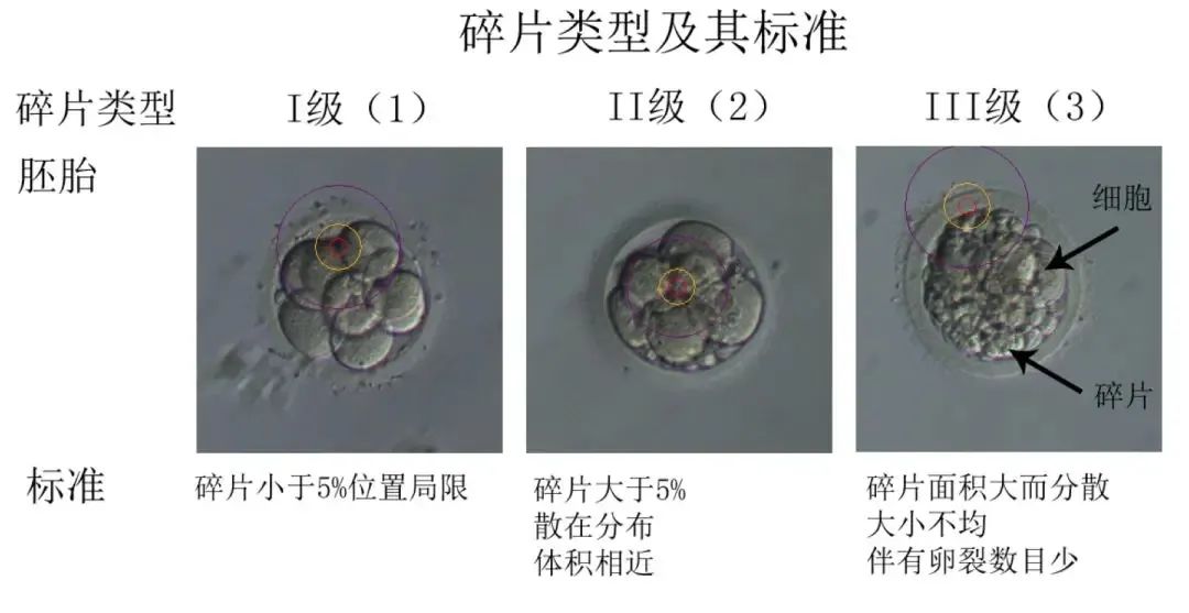 试管婴儿优质胚胎的标准是什么？试管婴儿取卵后第3天胚胎去向如何抉择？