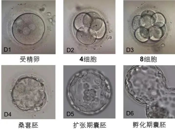 试管婴儿优质胚胎的标准是什么？试管婴儿取卵后第3天胚胎去向如何抉择？