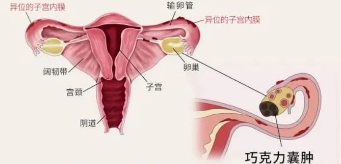 试管婴儿过程中哪些关键因素可能导致胚胎染色体异常？发生胚胎染色体异常下次备孕应该怎么做？