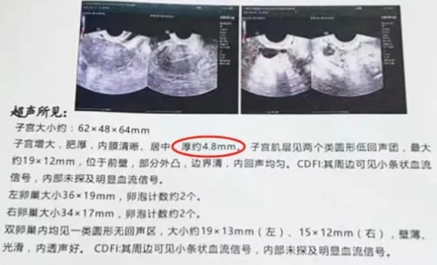 什么是PRP？PRP宫腔灌注治疗如何助力试管婴儿成功？PRP宫腔灌注适合哪类人群？