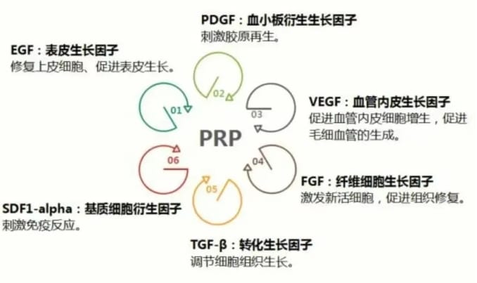 什么是PRP？PRP宫腔灌注治疗如何助力试管婴儿成功？PRP宫腔灌注适合哪类人群？