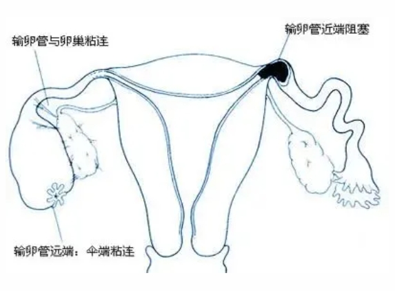 试管婴儿来“助攻”，让中秋更圆满！试管婴儿技术如何帮助不孕不育家庭实现生育梦想？