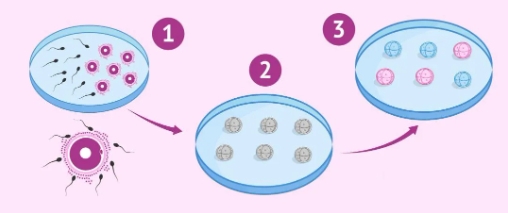 试管婴儿来“助攻”，让中秋更圆满！试管婴儿技术如何帮助不孕不育家庭实现生育梦想？