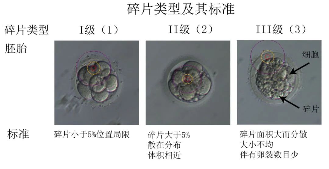 试管婴儿优质胚胎为何解冻后会掉级？胚胎冷冻过程真的会损伤胚胎质量吗？